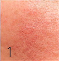 무너지는 피부 장벽 상세컷