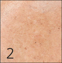 칙칙한 피부 상세컷